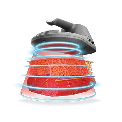 bsesculpt ems machine